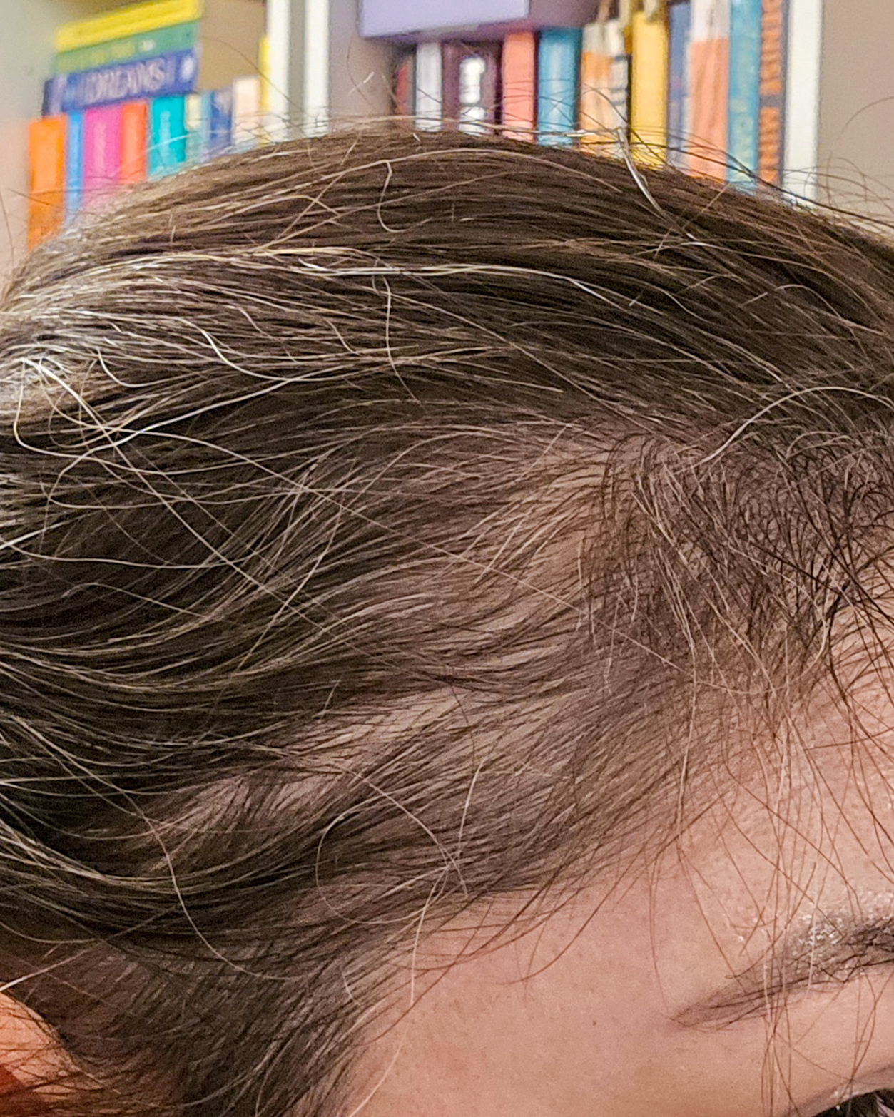 What Helped My Hair Grow Back After Postpartum Shedding